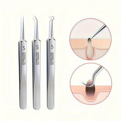 1/3pcs Extra Fine No. 5 Cellular Acne Blackhead Tweezers | Facial Beauty Tool for Skin Care