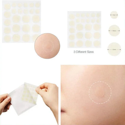 24 Pcs Hydrocolloid Acne Patches | Pimple Spot Treatment Stickers for Face
