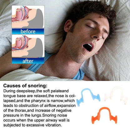 Nasal Dilator for Snoring | Stop Snoring Aid for Better Sleep