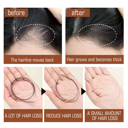Batana Oil From Honduras - Get Fuller, Thicker, Healthier Hair - Great Gifts For Women Men Conditioner Haircare Silky - Hair Nutrition